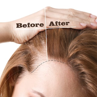 Foto 4 | Aceite para el Crecimiento del Cabello Ebin New York Hail Lightweight 100 Ml - Venta Internacional