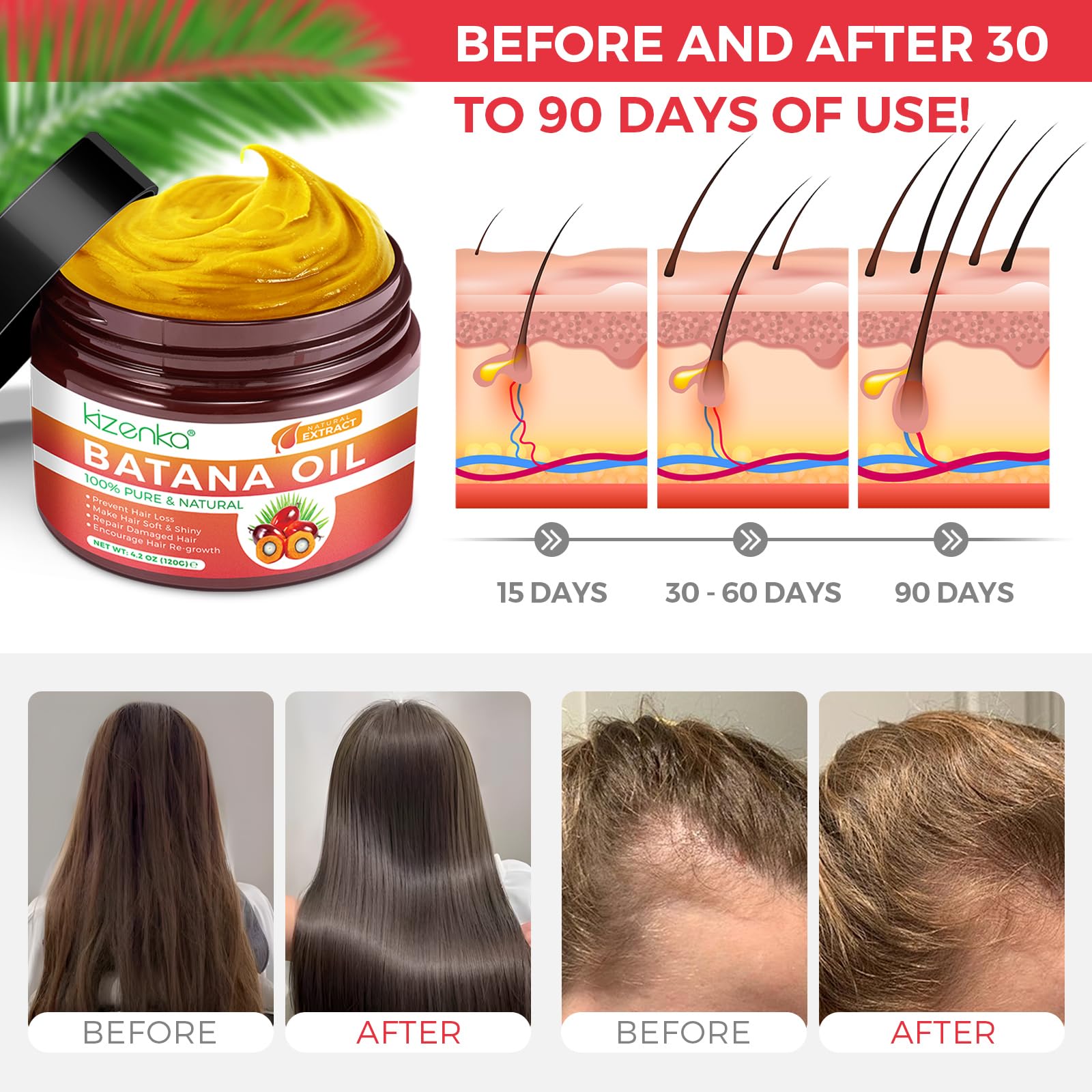 Foto 5 | Aceite De Batana Para El Crecimiento Del Cabello Genérico, 60 Ml, 100% Puro Y Natural - Venta Internacional.