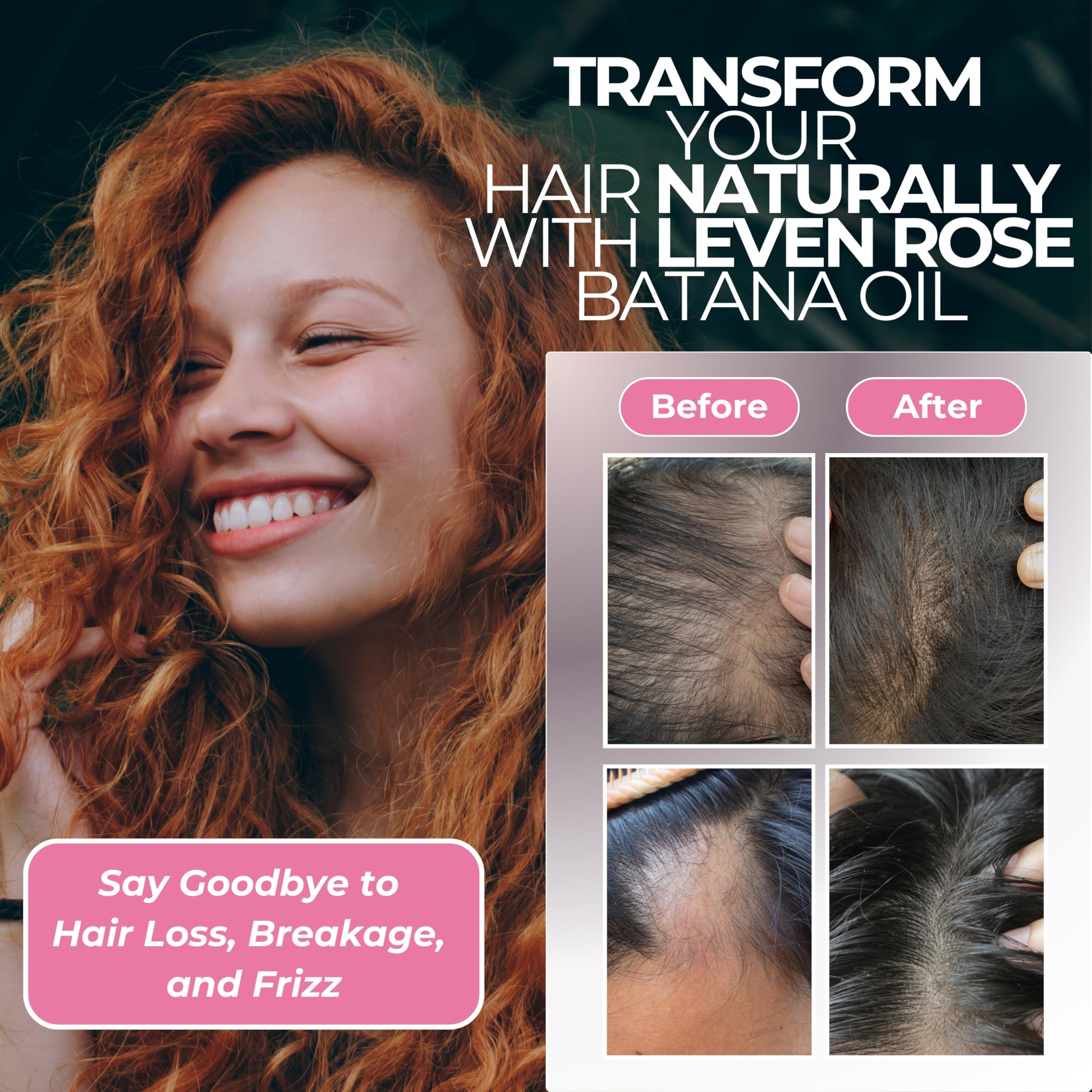 Foto 5 | Aceite Leven Rose Batana 100% Crudo, 120 Ml, Para El Crecimiento Del Cabello - Venta Internacional.