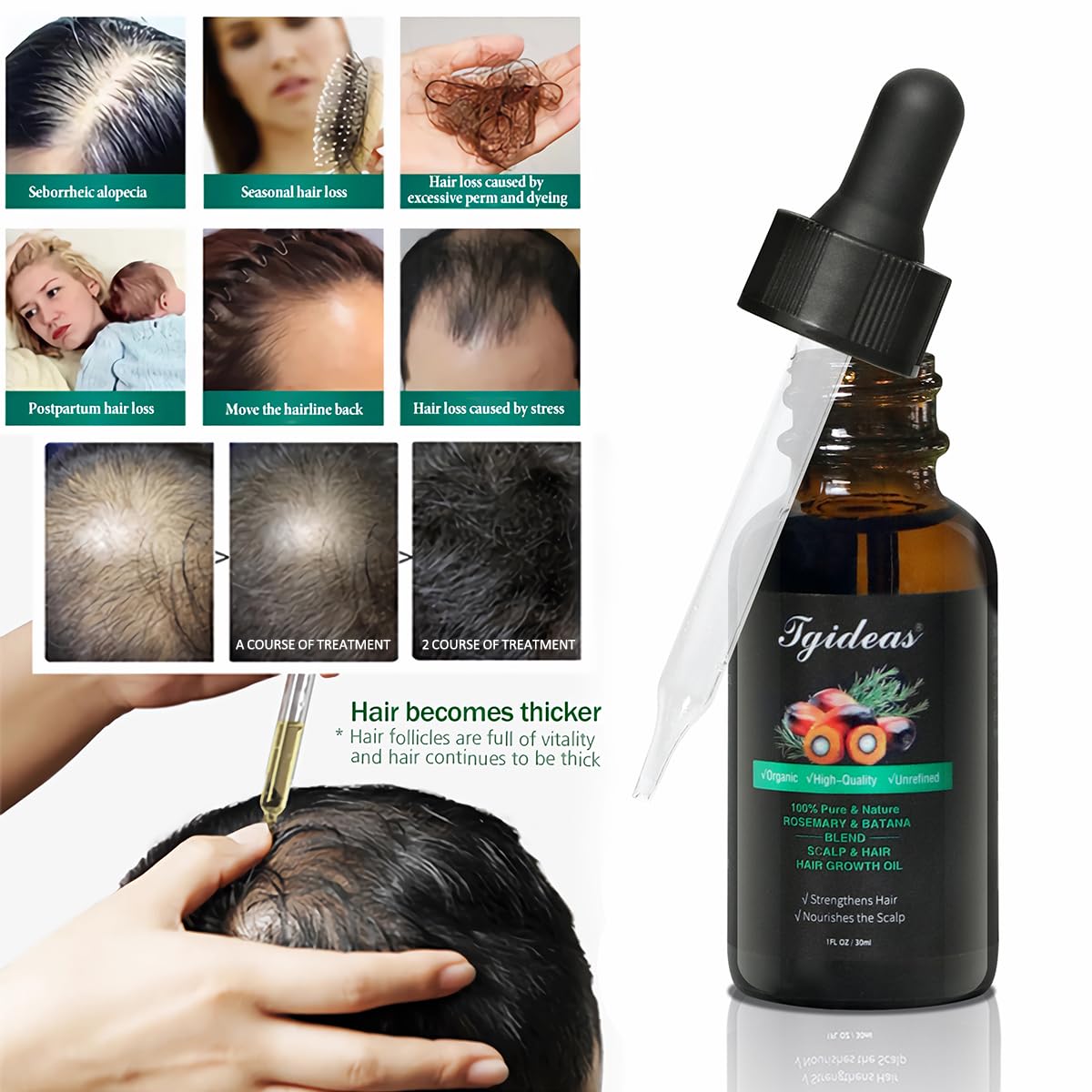 Foto 6 pulgar | Aceite Para El Crecimiento Del Cabello Tgideas Batana Rosemary Organic 30 Ml - Venta Internacional.