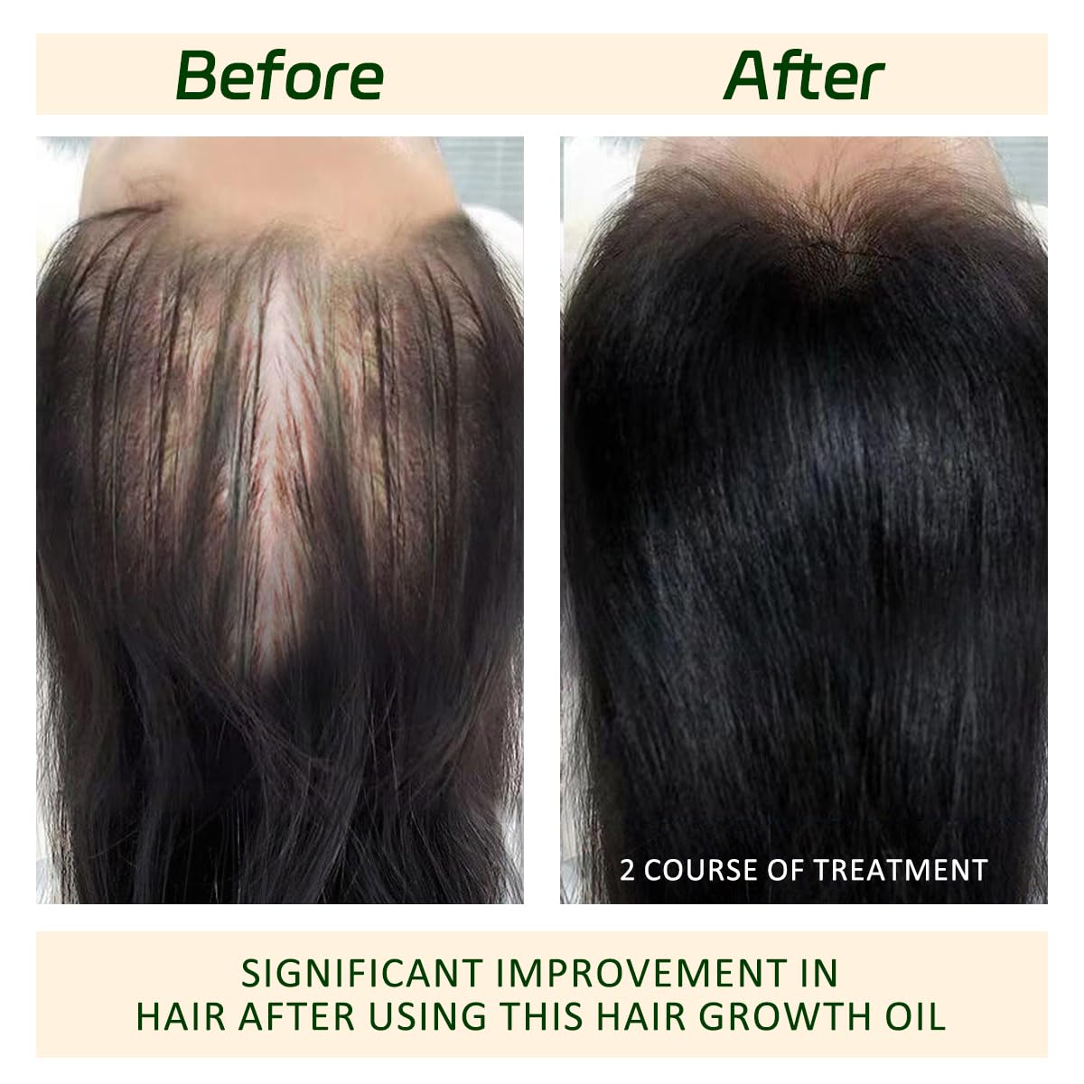 Foto 7 pulgar | Aceite Para El Crecimiento Del Cabello Tgideas Batana Rosemary Organic 30 Ml - Venta Internacional.