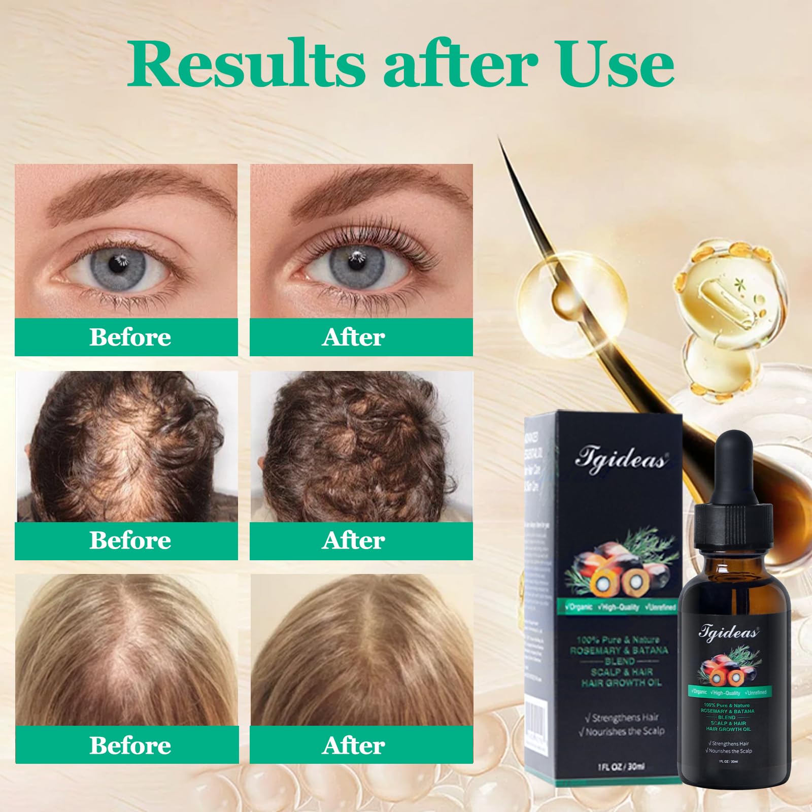 Foto 6 | Aceite Para El Crecimiento Del Cabello Tideas Organic Rosemary & Batana, 2 Paquetes - Venta Internacional.