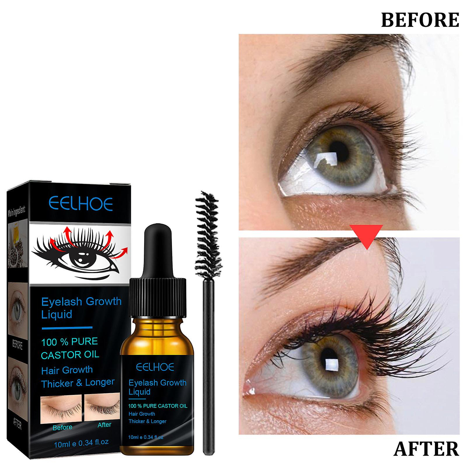 Foto 6 pulgar | El Aceite De Ricino Huoguo Promueve El Crecimiento Del Cabello  Las Cejas Y Las Pestañas - Venta Internacional.