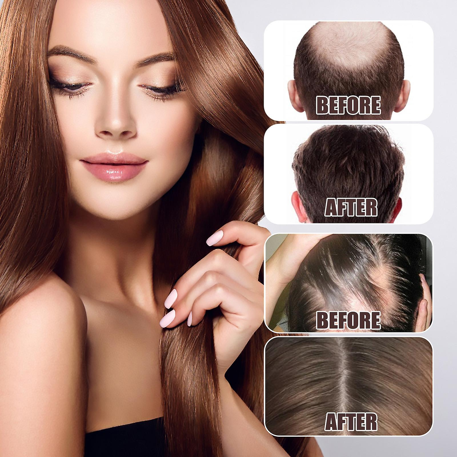Foto 4 pulgar | Mascarilla Capilar Huoguo Advanced Essential Oil 30 Ml Para Cabello Dañado - Venta Internacional.