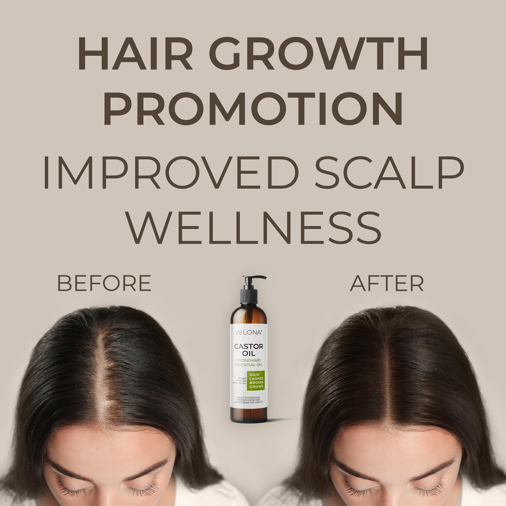 Foto 4 pulgar | Aceite De Ricino Para El Crecimiento Del Cabello 100% Natural  240 Ml Con Romero - Venta Internacional.