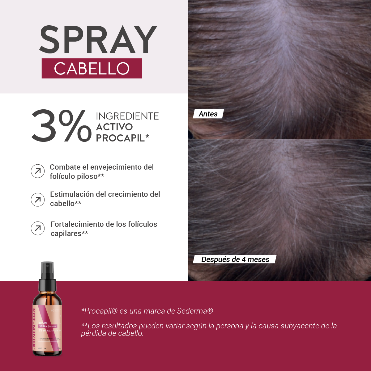 Foto 4 pulgar | Espray Crecimiento Cabello para Mujer Not-Minox 3% Ingrediente Activo 90 ml