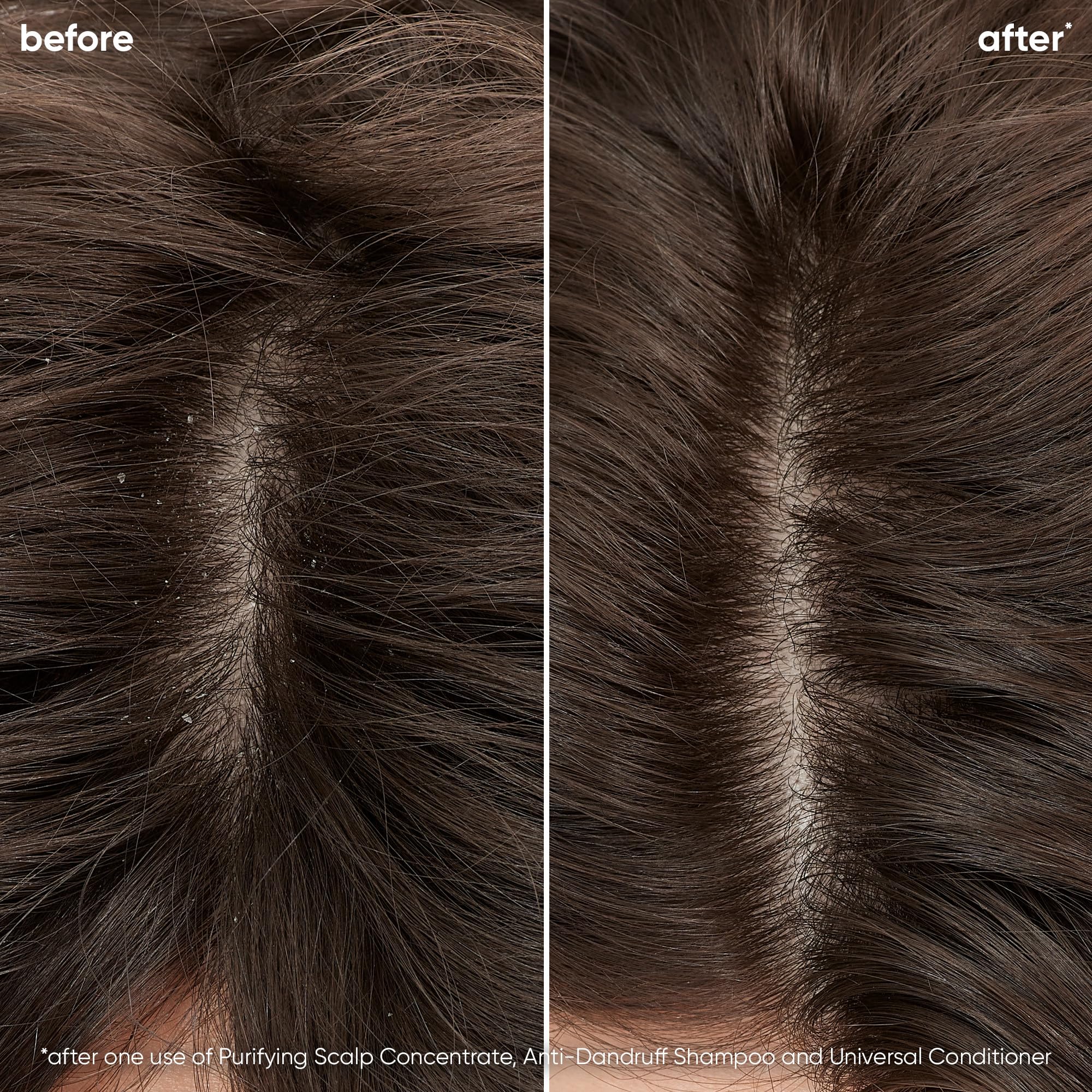 Foto 3 pulgar | Tratamiento para El Cuero Cabelludo Biolage Biolage Scalp Sync Purifying - Venta Internacional