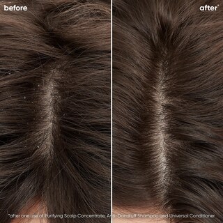 Foto 2 | Tratamiento para El Cuero Cabelludo Biolage Biolage Scalp Sync Purifying - Venta Internacional
