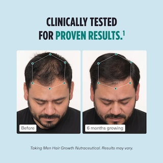 Foto 5 | Suplemento Y Sérum Para El Crecimiento Del Cabello Nutrafol Men, 1.7 Oz, Suministro De 1 M - Venta Internacional.