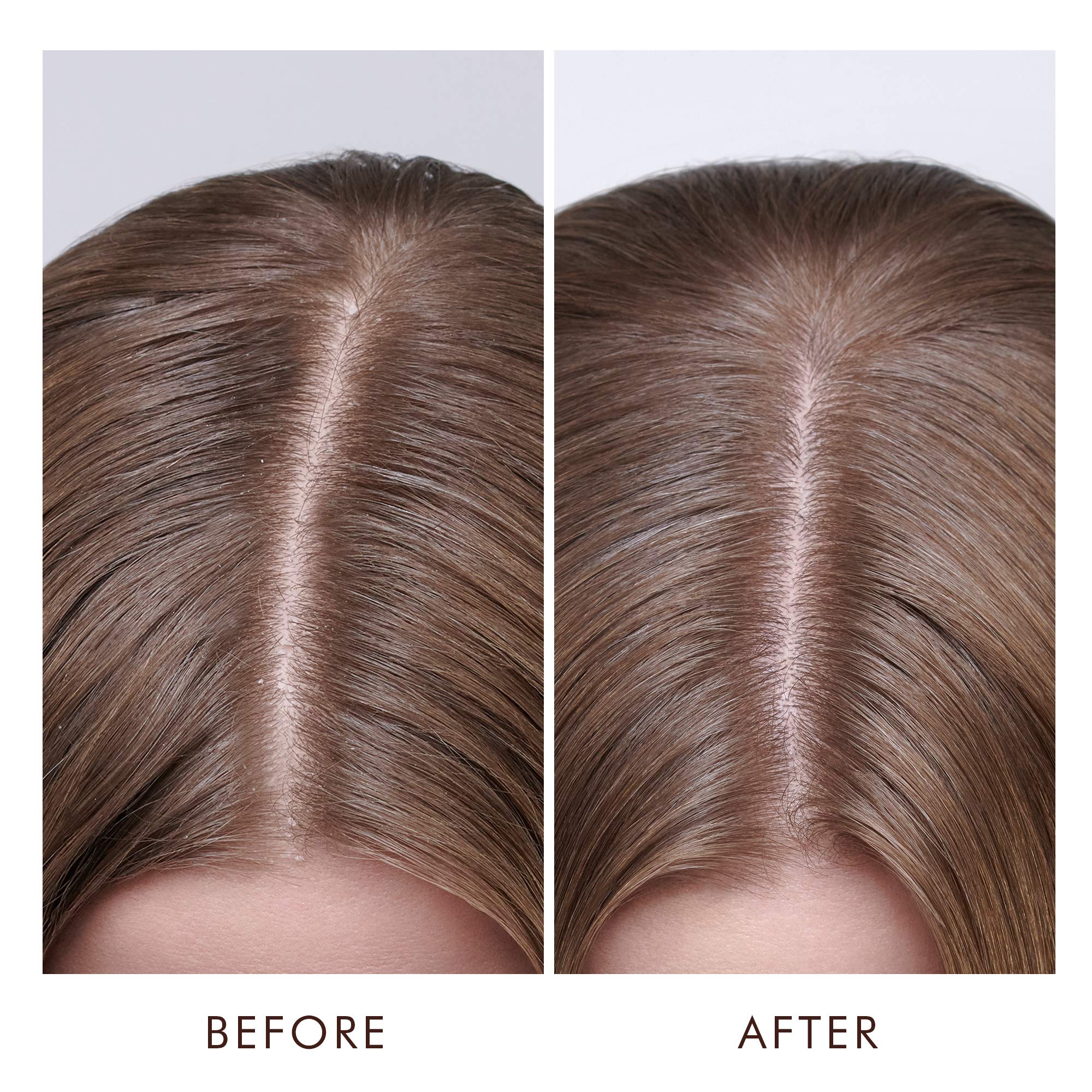 Foto 5 pulgar | Tratamiento Para Cuero Cabelludo Seco Moroccanoil 45 Ml - Venta Internacional.