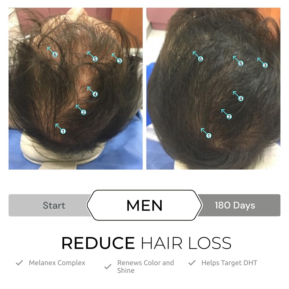 Foto 7 pulgar | Sérum Capilar Ds Laboratories Spectral.dnc-s Hair Growth - Venta Internacional.