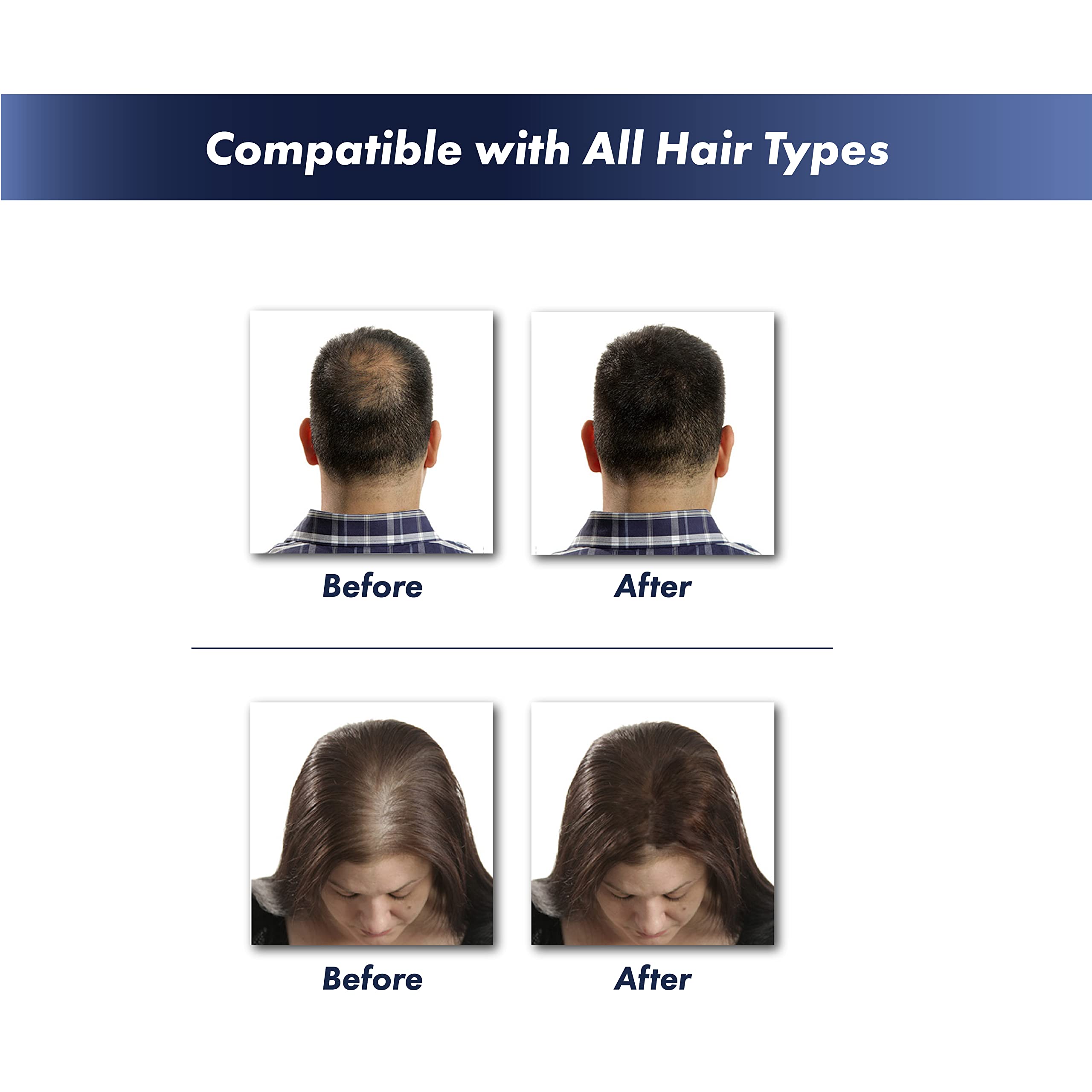 Foto 3 pulgar | Fibras Capilares Kerafiber Natural Keratin Marrón Medio - Venta Internacional