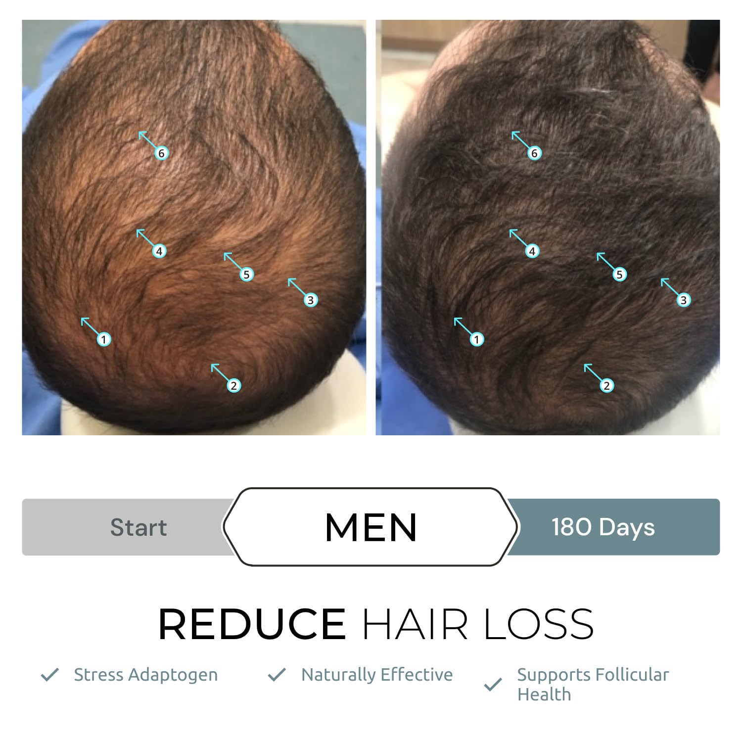 Foto 6 | Suplemento DS Laboratories Revita.SOD en Tabletas contra la Caída del Cabello - Venta Internacional