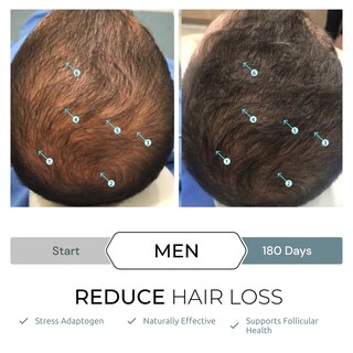 Foto 6 | Suplemento DS Laboratories Revita.SOD en Tabletas contra la Caída del Cabello - Venta Internacional