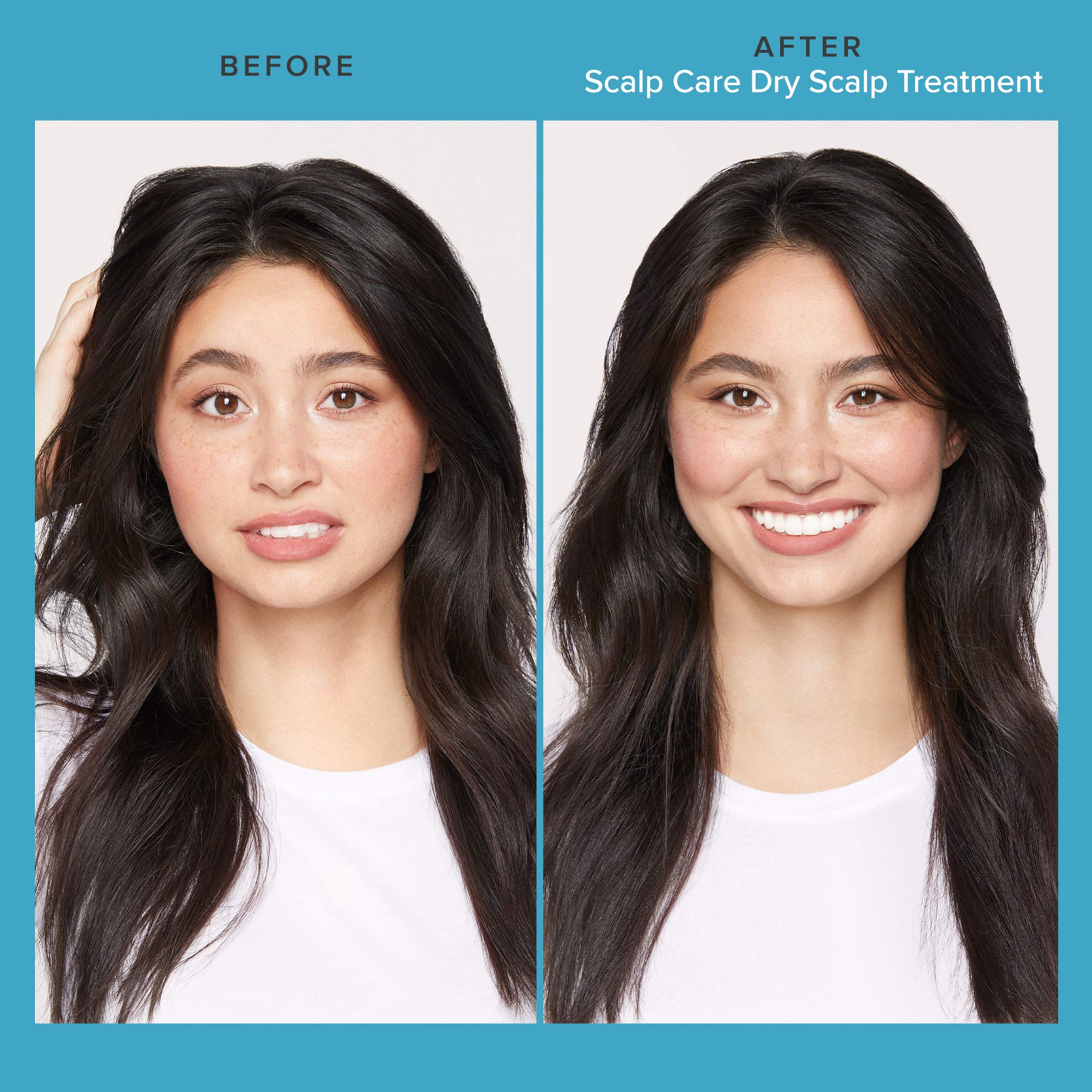 Foto 2 | Tratamiento Para Cuero Cabelludo Seco Living Proof Scalp Care Hydration - Venta Internacional.