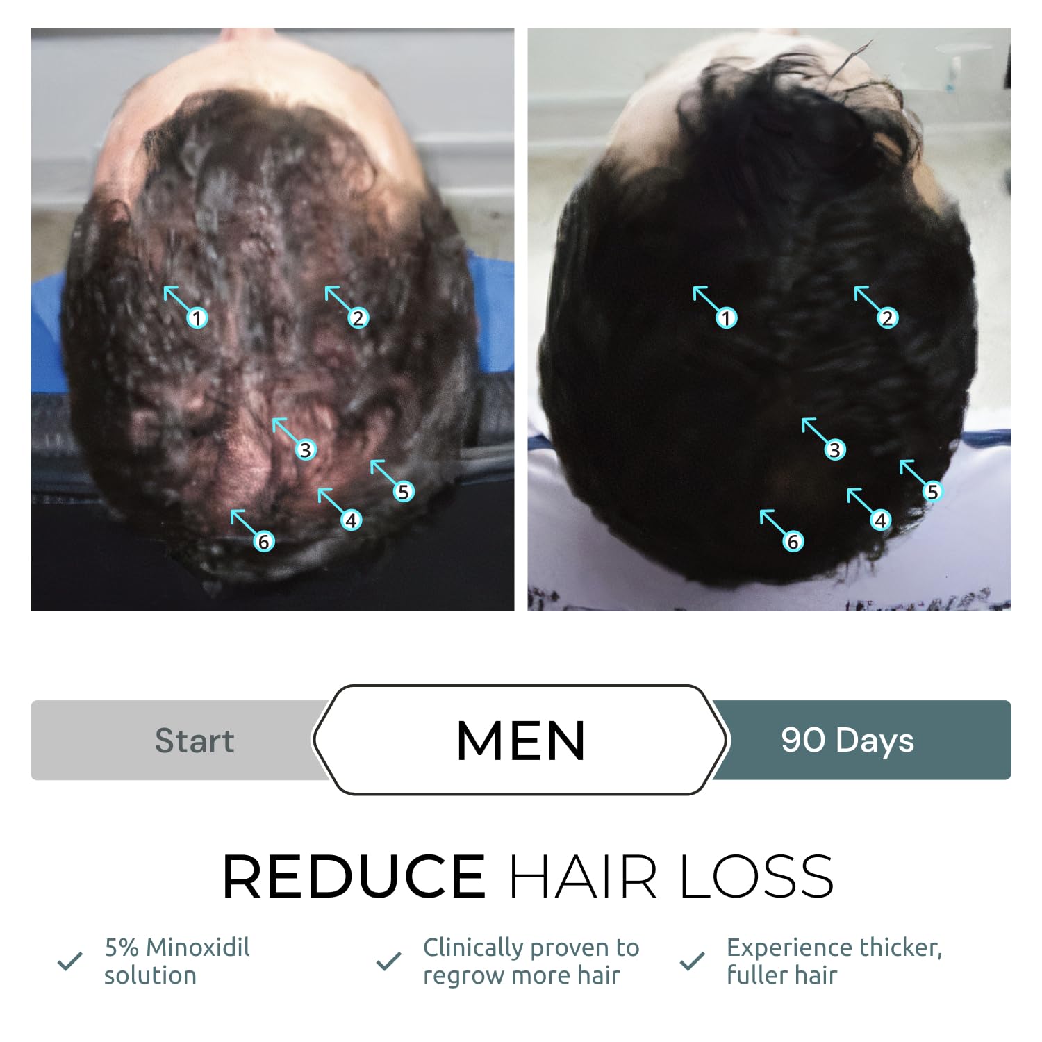 Foto 8 pulgar | Sérum Capilar Ds Laboratories Spectral.f7 Hair Recgrowth - Venta Internacional.