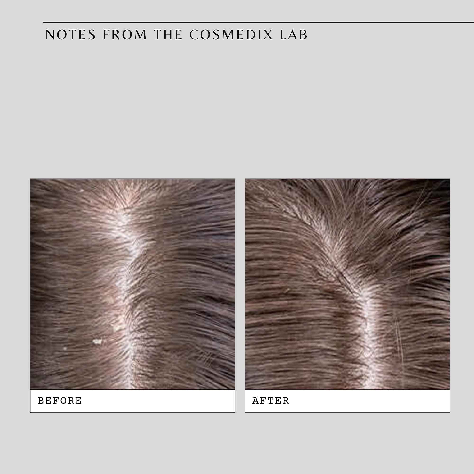 Foto 5 | Tratamiento Para El Cuero Cabelludo Cosmedix Fortify Cooling Enzyme, 1 Unidad - Venta Internacional.