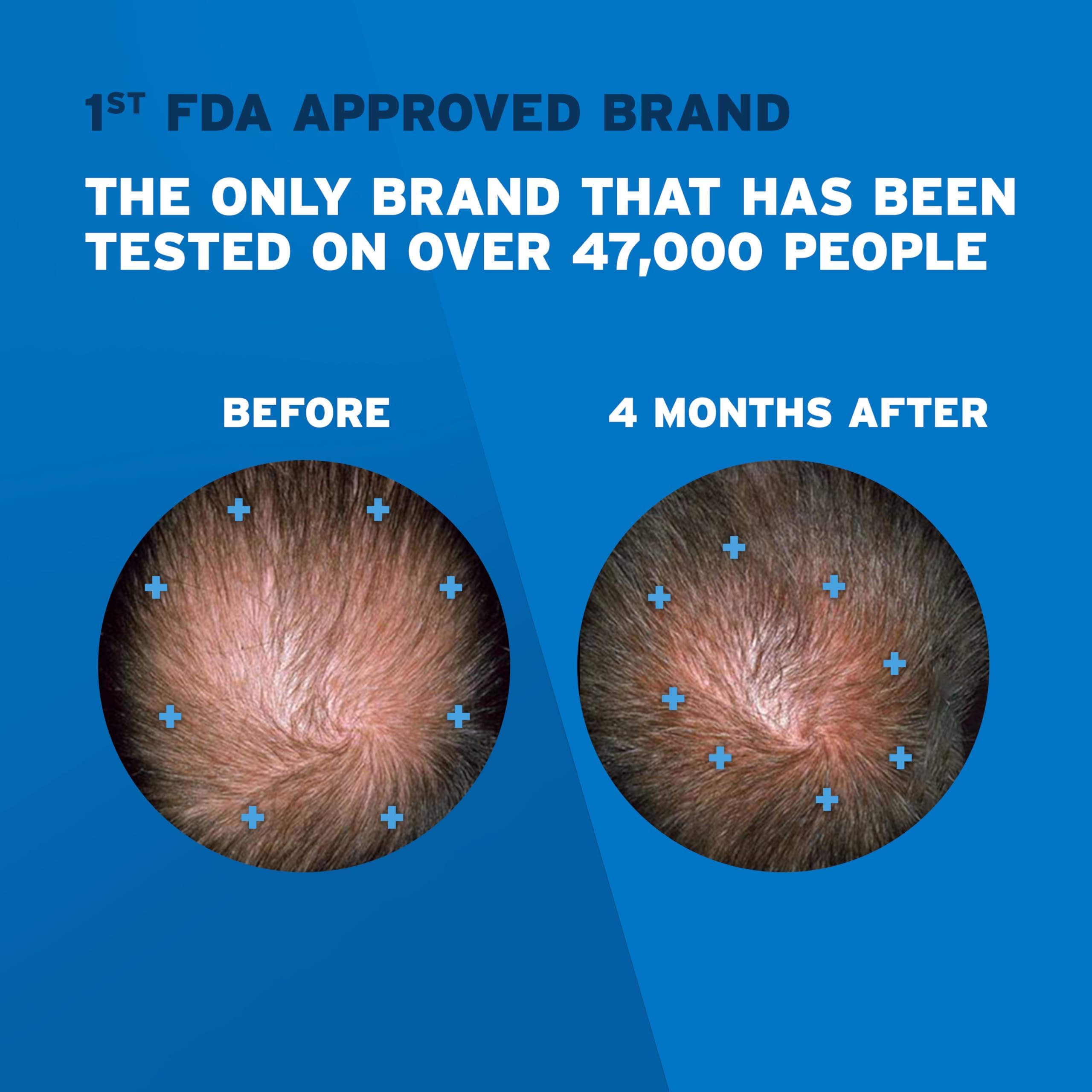 Foto 3 | Tratamiento Para El Crecimiento Del Cabello Rogaine Extra Strength 5% Minoxidil - Venta Internacional.