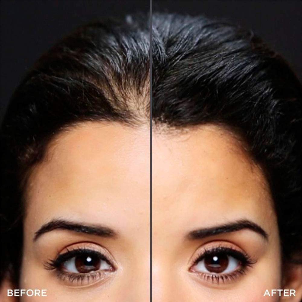 Foto 8 pulgar | Hairline Optimizer Toppik, Paquete De 1 - Venta Internacional.
