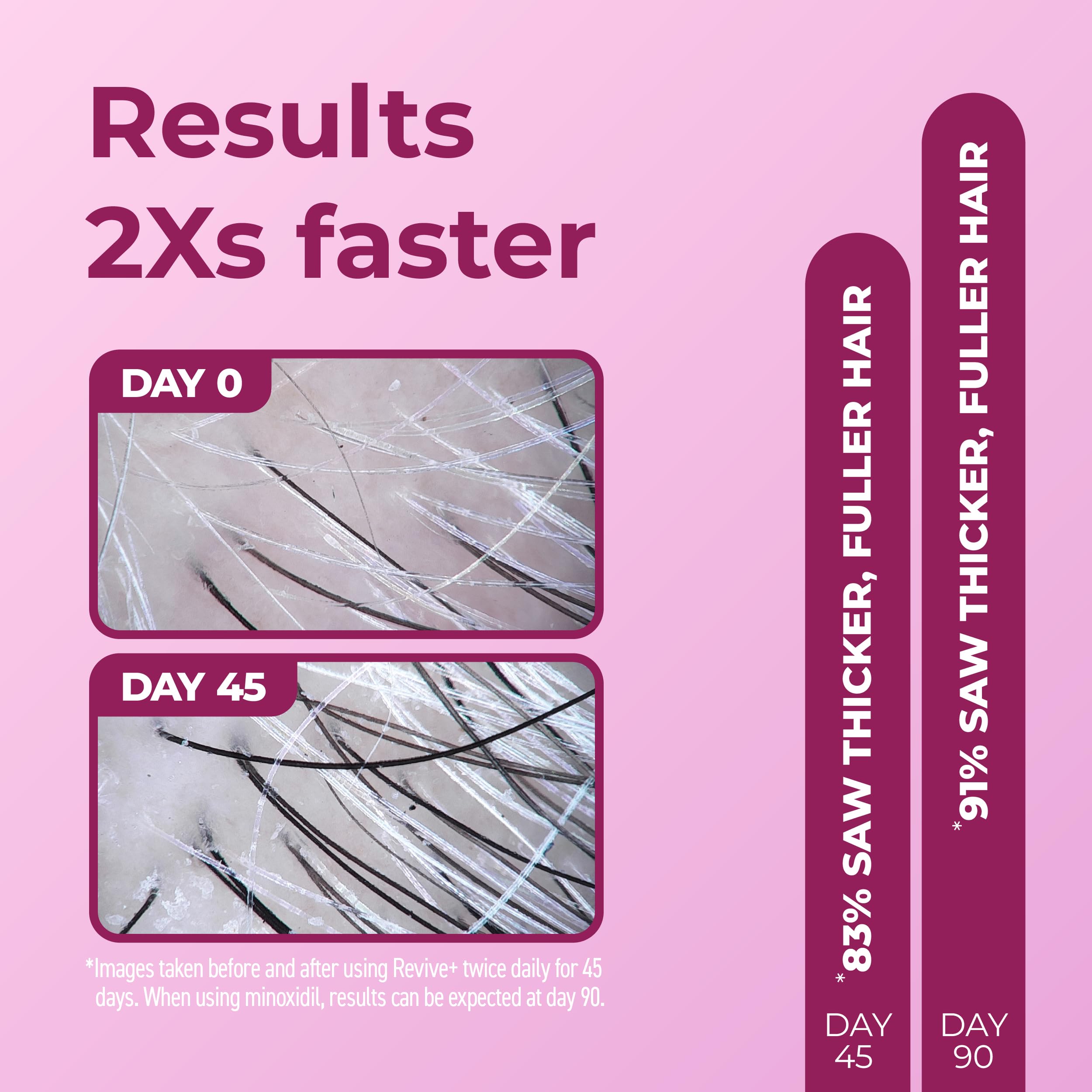 Foto 5 pulgar | Espuma De Tratamiento Densificante Para Cabello Bosleymd Revive+ Para Mujer - Venta Internacional.