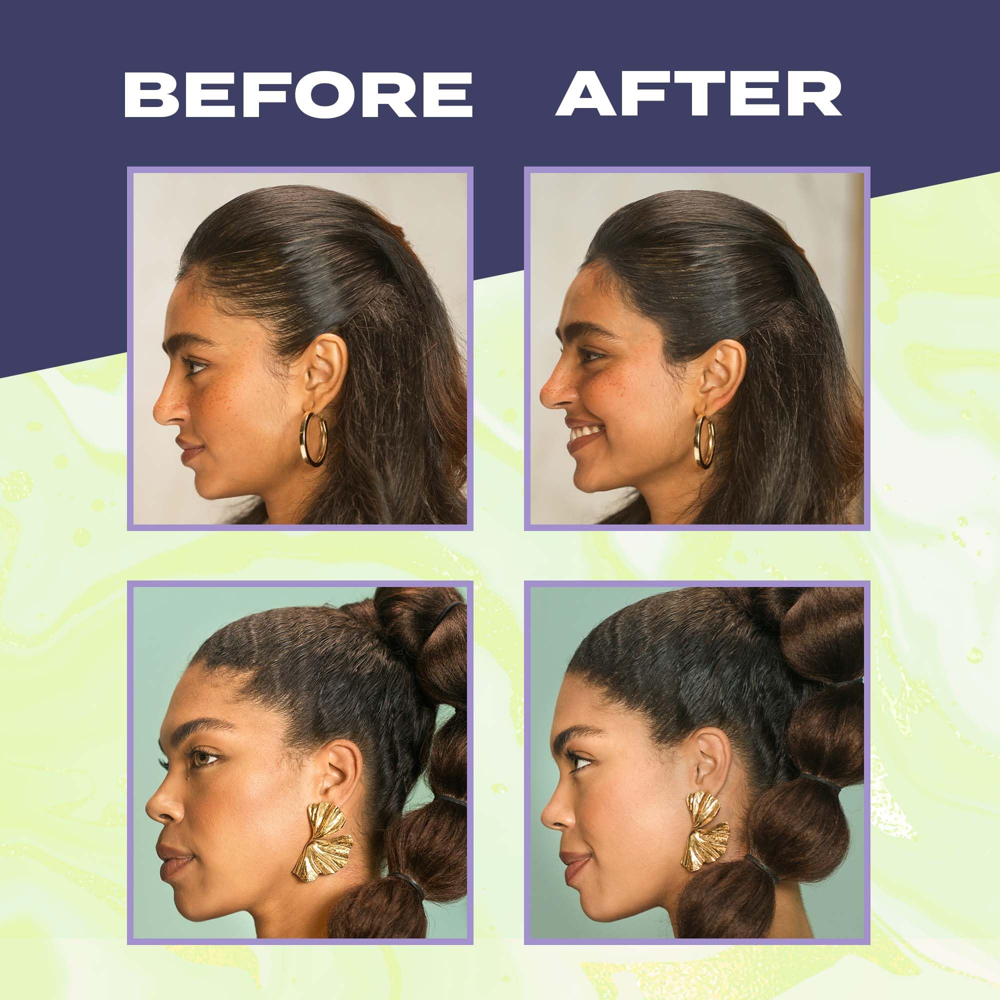 Foto 6 pulgar | Hairline Filler Toppik Fill Me In Hair Tinte Root Black 5 G - Venta Internacional.