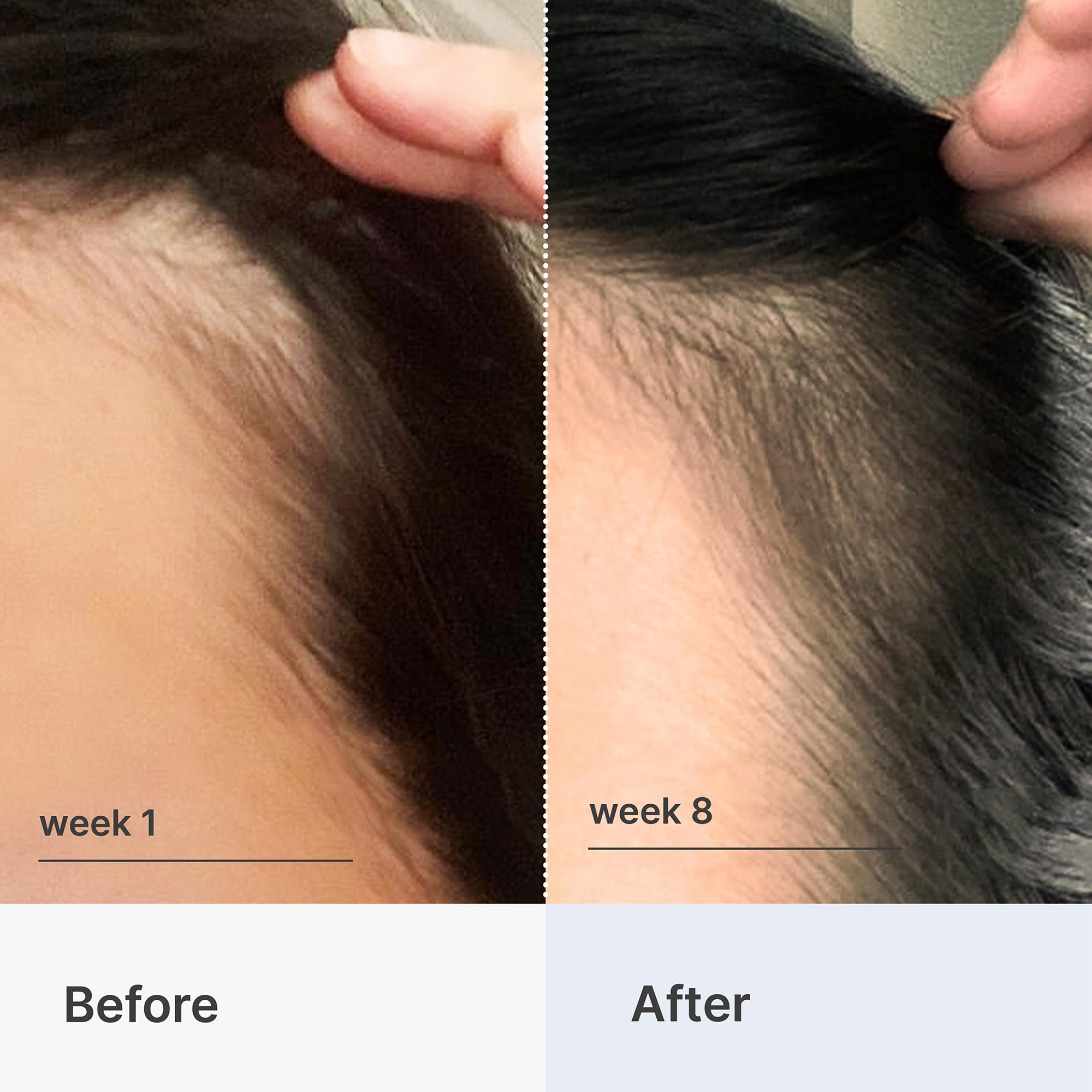 Foto 4 pulgar | Sérum Fortificante Para El Cabello Better Not Younger Para Mujeres Mayores De 40 Ml - Venta Internacional.