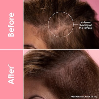 Foto 7 | Sérum Capilar Grande Cosmetics Promueve El Grosor De 40 Ml - Venta Internacional.