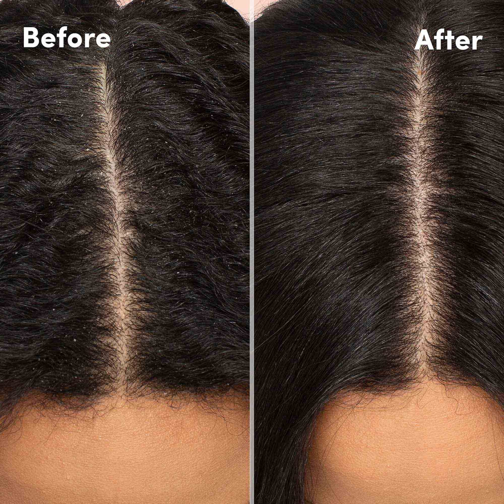 Foto 5 pulgar | Loción Para Cuero Cabelludo Mizani Scalp Care Calming Caspa 120 Ml Curly - Venta Internacional.
