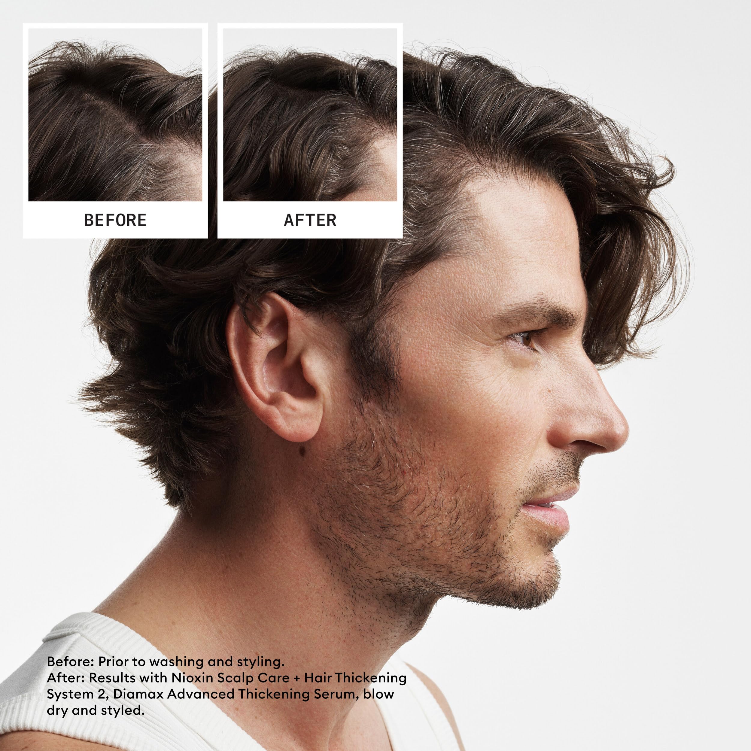 Foto 6 | Kit De Tratamiento Capilar Nioxin System 2 Para Fortalecer Y Engrosar - Venta Internacional.