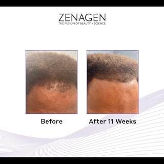 Foto 3 | Tratamiento Anticaída Zenagen Revolve Thickening 480 Ml Para Hombres - Venta Internacional.