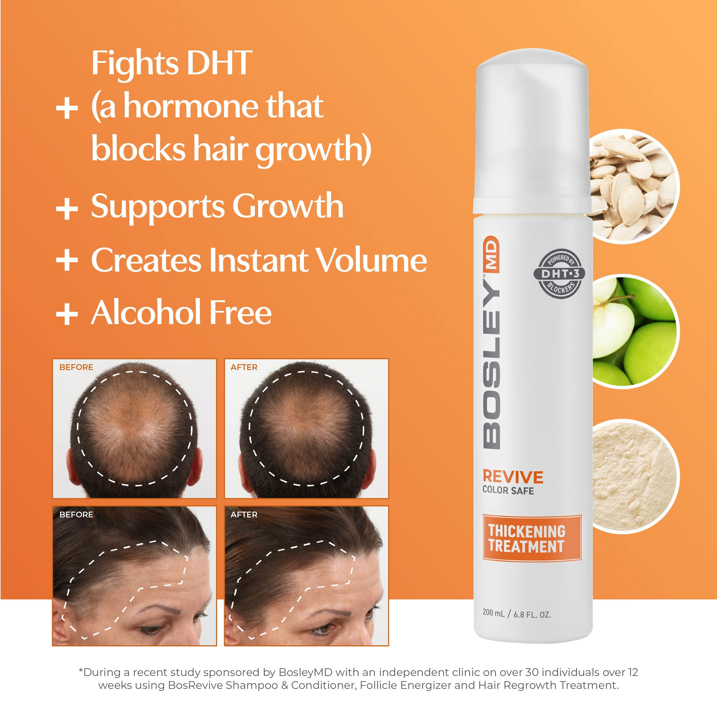 Foto 2 | Tratamiento Para Adelgazar El Cabello Bosleymd Bosrevive Starter 30 Días - Venta Internacional.