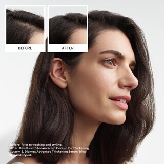 Foto 3 | Sistema De Engrosamiento Capilar Nioxin 3 Para Cabello Teñido O Dañado - Venta Internacional.
