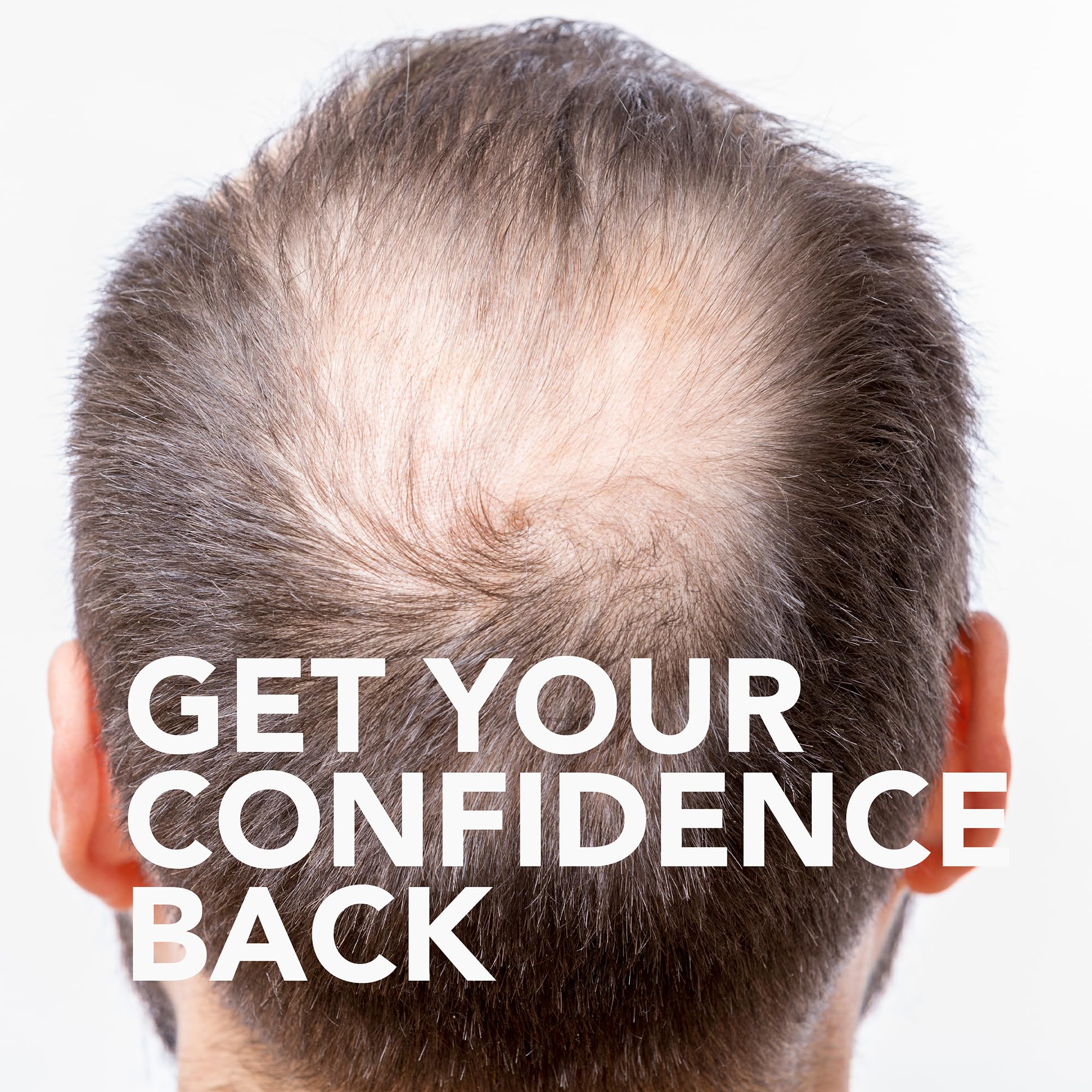 Foto 4 pulgar | Tratamiento Para El Crecimiento Del Cabello Goodsense Minoxidil 5% 355 Ml Para Hombres - Venta Internacional.