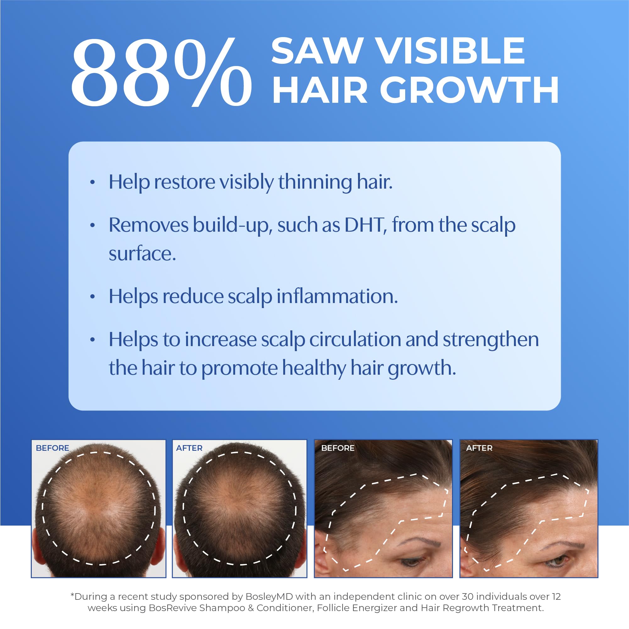 Foto 5 pulgar | Champú Bosleymd Bosrevive Nourishing 1l Para Cabello Fino - Venta Internacional.