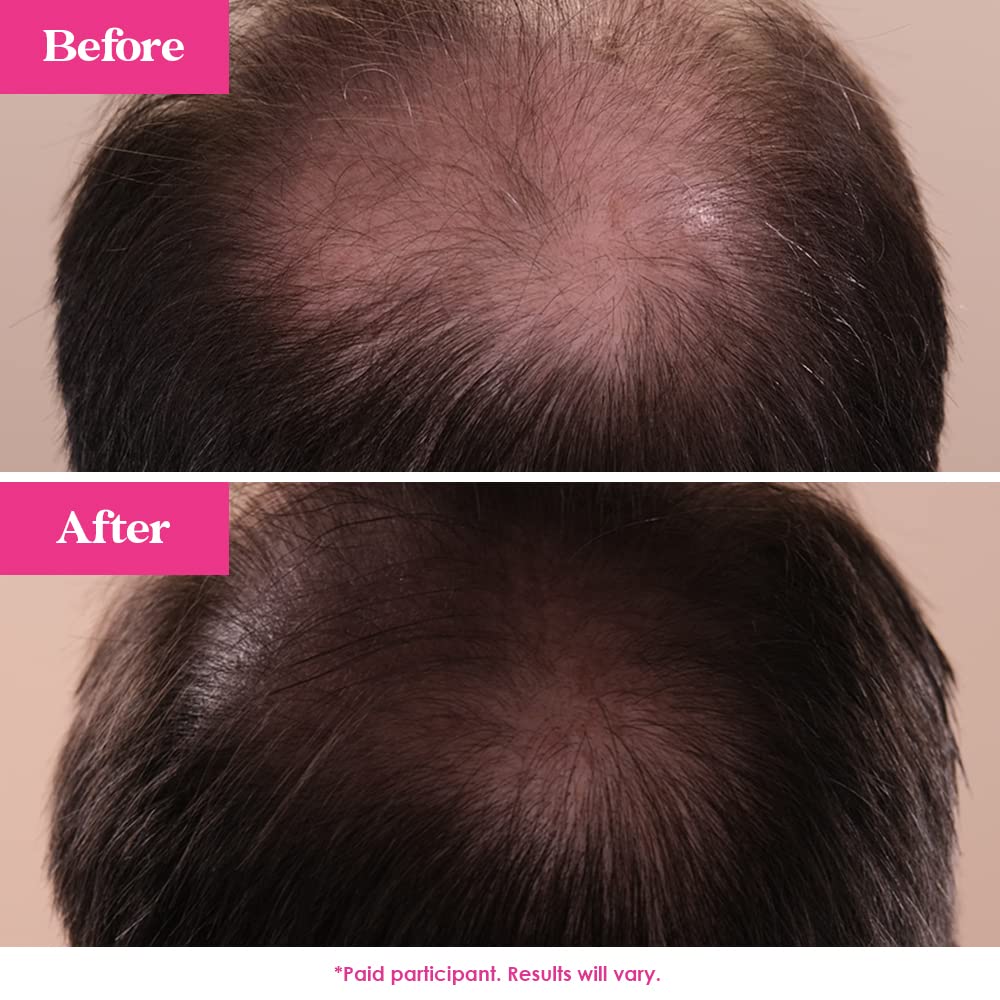 Foto 7 pulgar | Serum Grande Cosmetics Grandehair Enhancing 20 Ml - Venta Internacional.