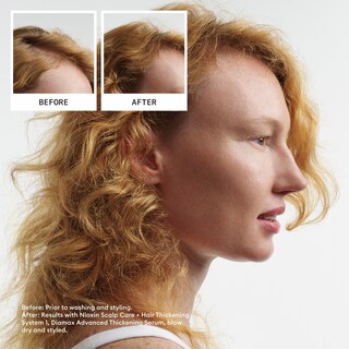 Foto 3 | Leave On Treatment Nioxin Scalp + Hair Thickening System 1 - Venta Internacional.