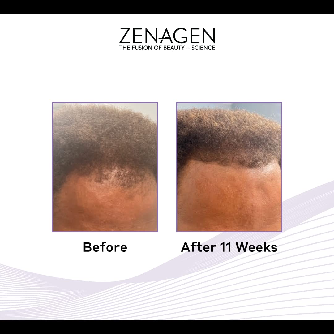 Foto 4 pulgar | Champú Zenagen Revolve Para Espesar Y Perder El Cabello, 960 Ml, Para Hombres - Venta Internacional.