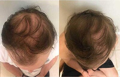 Foto 7 | Champú Zenagen Revolve Para Espesar Y Perder El Cabello, 960 Ml, Para Hombres - Venta Internacional.