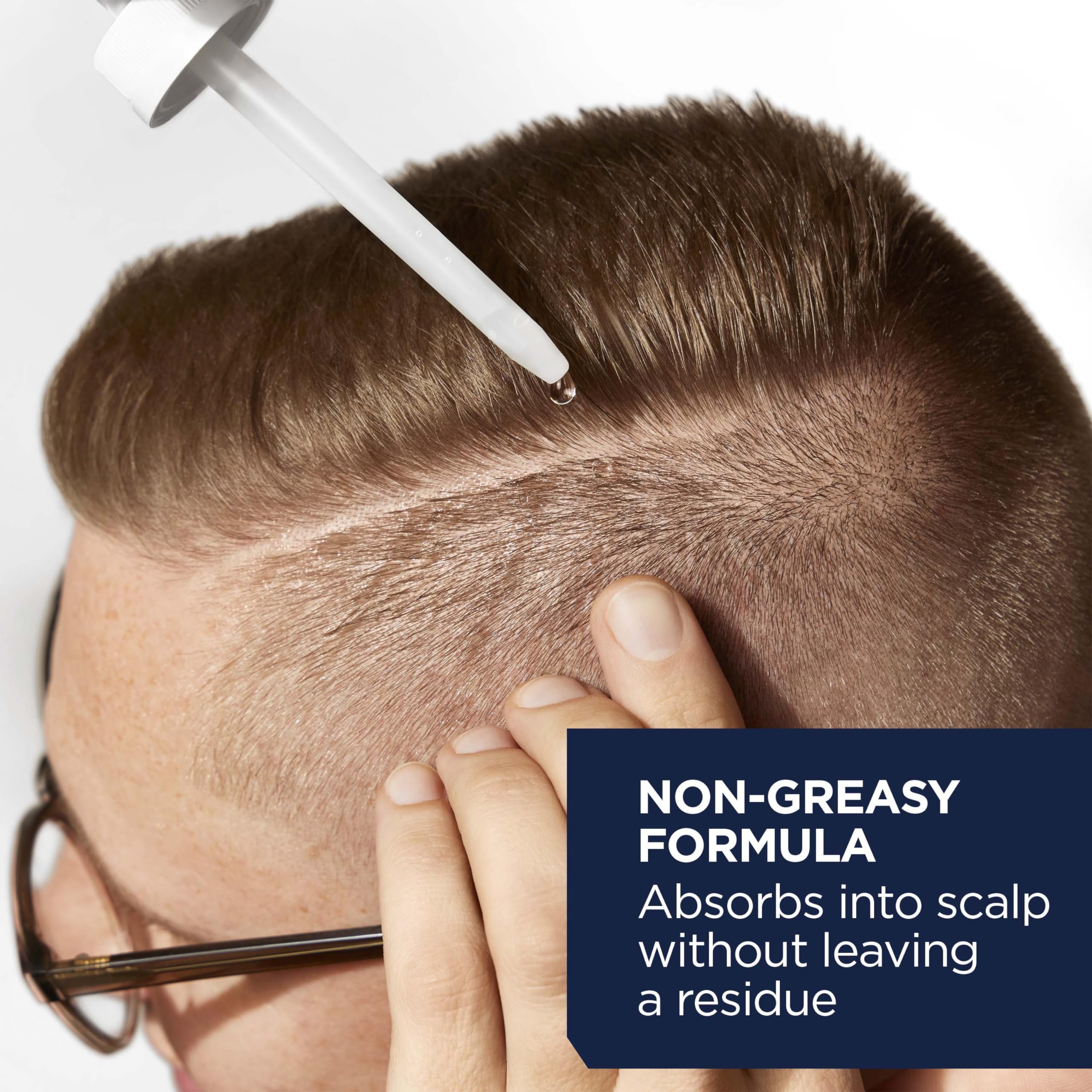Foto 4 pulgar | Tratamiento Para El Crecimiento Del Cabello, Cabeza Y Hombros, Cuero Cabelludo X 5% De Minoxidil - Venta Internacional.