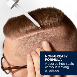 Foto 3 | Tratamiento Para El Crecimiento Del Cabello, Cabeza Y Hombros, Cuero Cabelludo X 5% De Minoxidil - Venta Internacional.