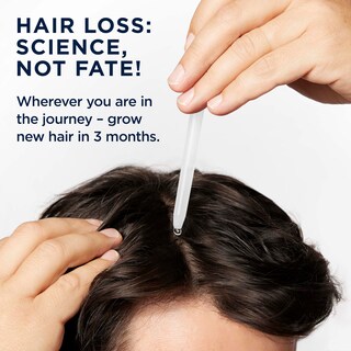 Foto 6 | Tratamiento Para El Crecimiento Del Cabello, Cabeza Y Hombros, Cuero Cabelludo X 5% De Minoxidil - Venta Internacional.