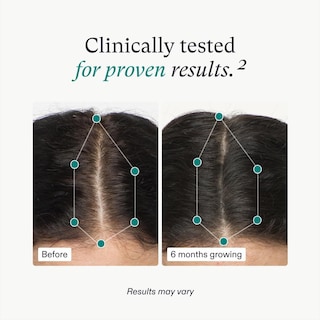 Foto 4 | Suplementos Para El Crecimiento Del Cabello Y Sérum Capilar Nutrafol Women - Venta Internacional.
