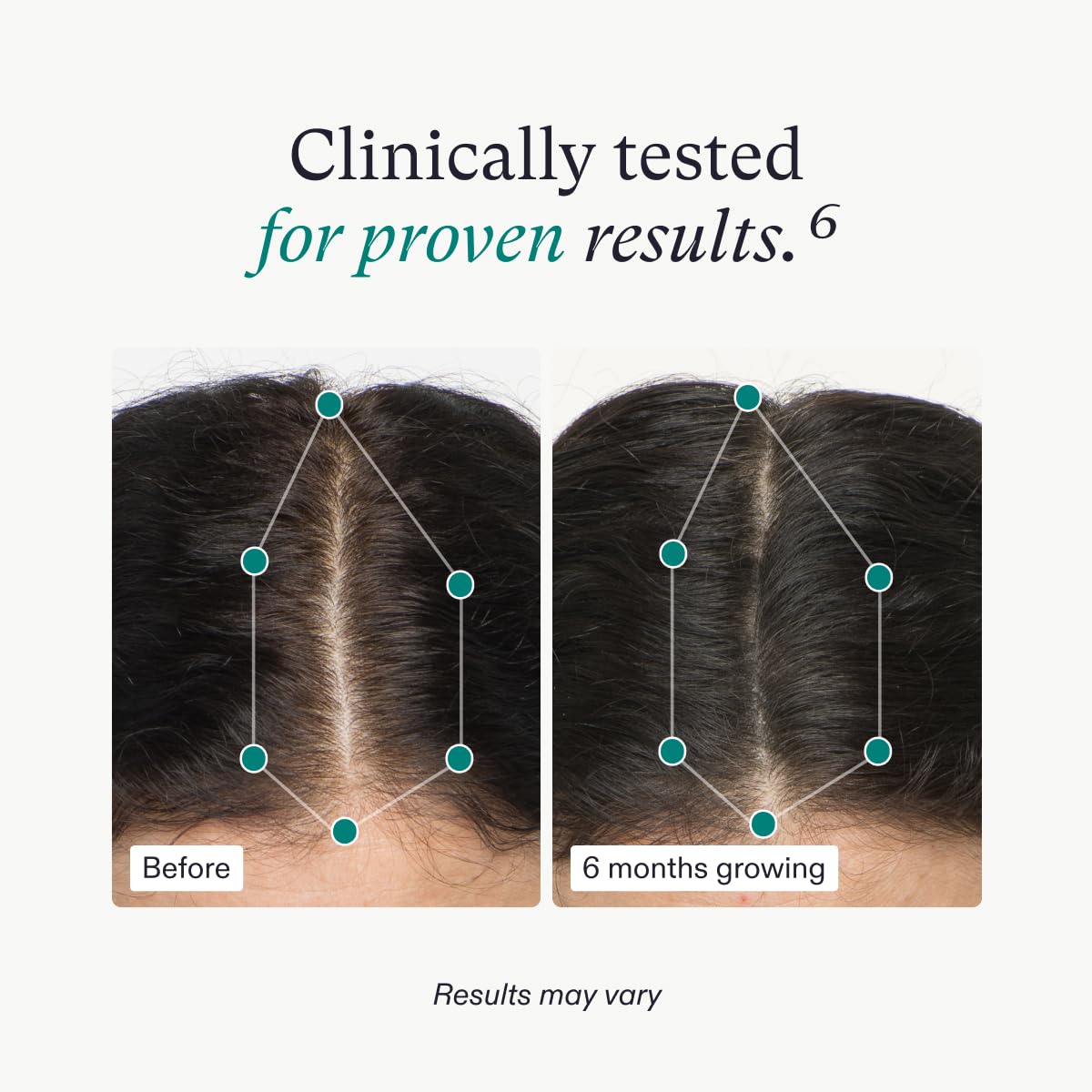 Foto 4 | Suplementos Para El Crecimiento Del Cabello Nutrafol Women 18-44 - 1 Mes - Venta Internacional.