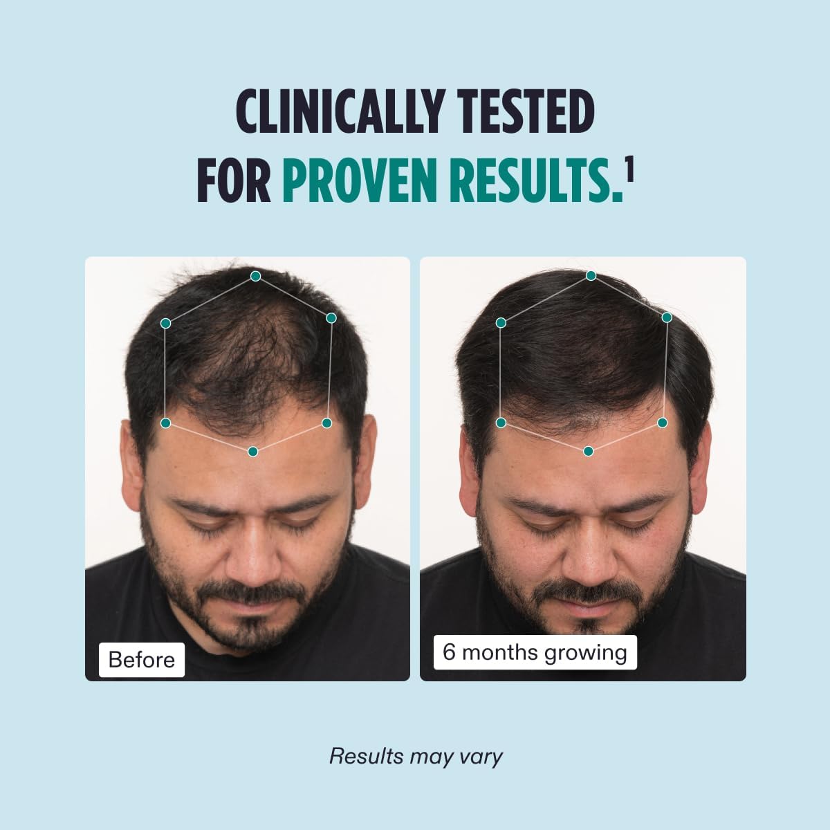 Foto 4 | Suplementos Para El Crecimiento Del Cabello Nutrafol Men, Suministro De 1 Mes - Venta Internacional.