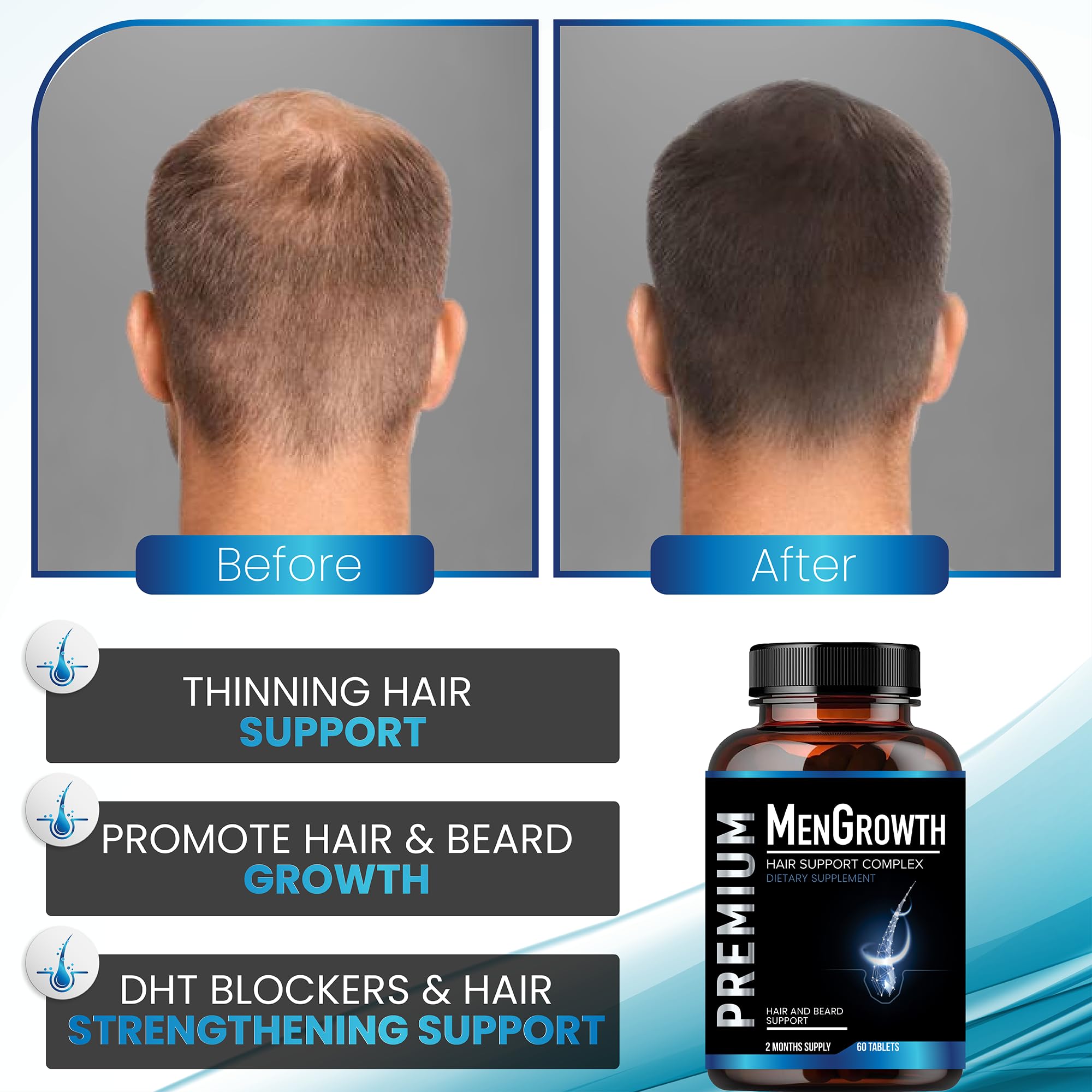 Foto 5 pulgar | Suplemento Para El Crecimiento Del Cabello Nutrapro Para Hombres Con Bloqueador De Dht - Venta Internacional.