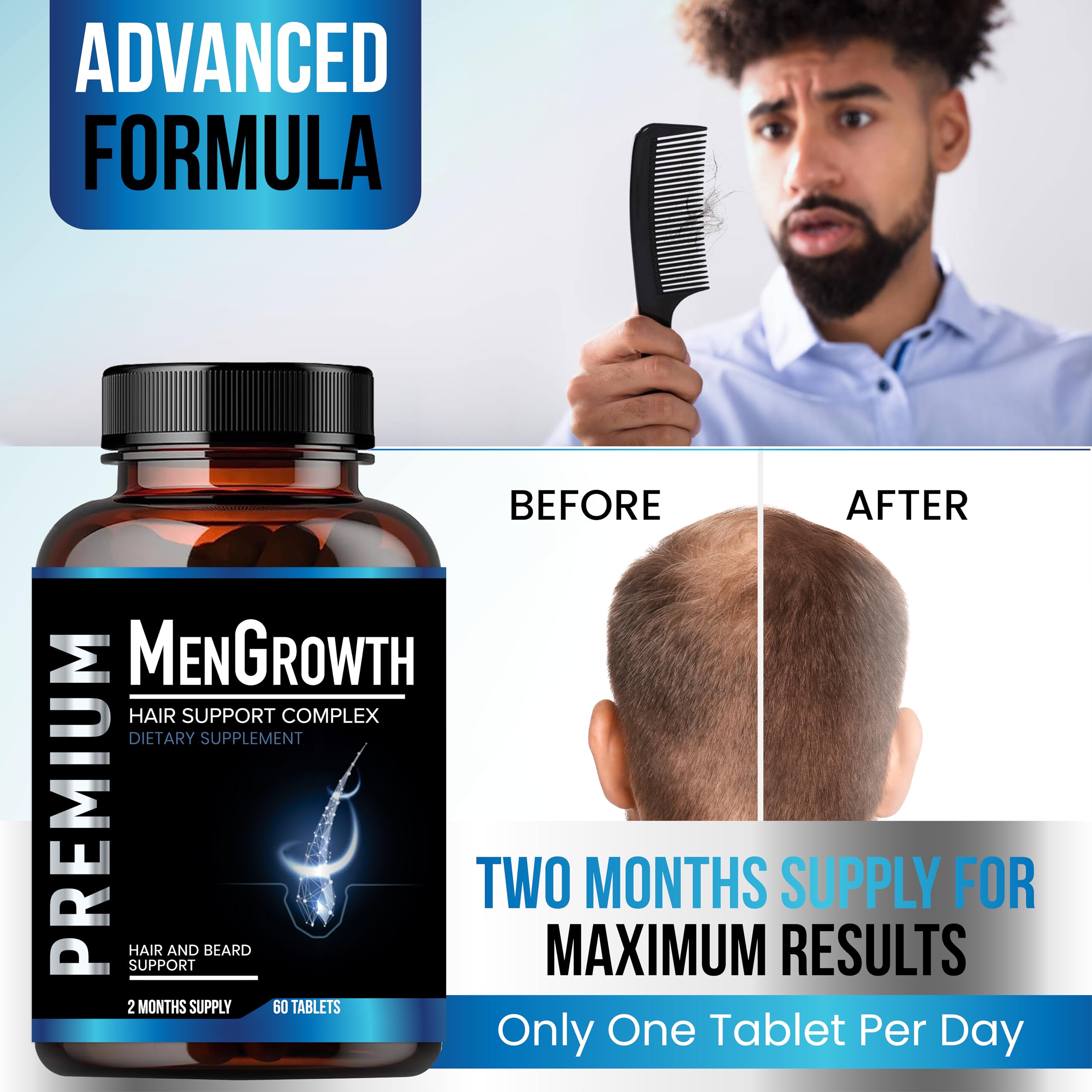 Foto 6 pulgar | Suplemento Para El Crecimiento Del Cabello Nutrapro Para Hombres Con Bloqueador De Dht - Venta Internacional.