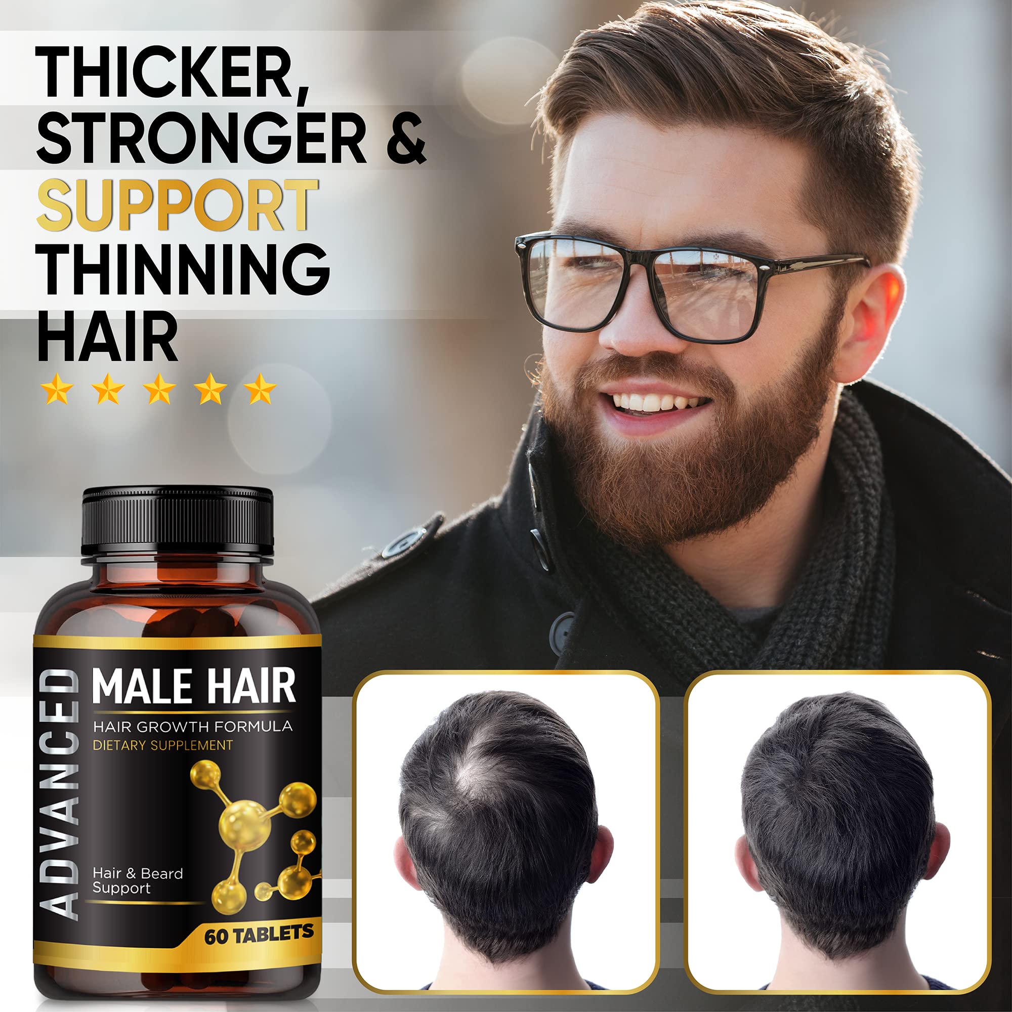 Foto 3 pulgar | Vitaminas Para El Crecimiento Del Cabello Nutrapro Para Hombres Con Biotina Y Vitaminas - Venta Internacional.