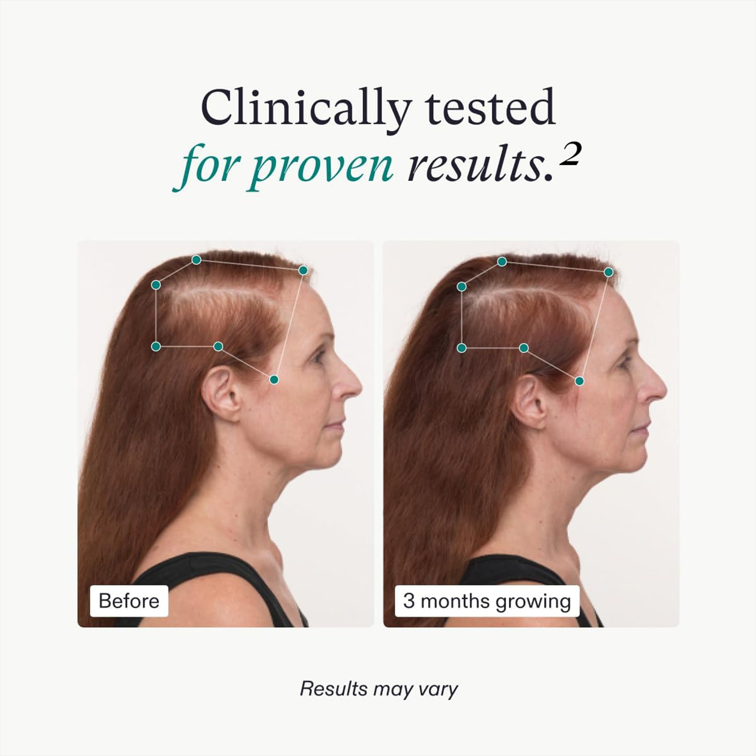 Foto 4 | Suplementos Para El Crecimiento Del Cabello Nutrafol Women's Balance 2 Month - Venta Internacional.