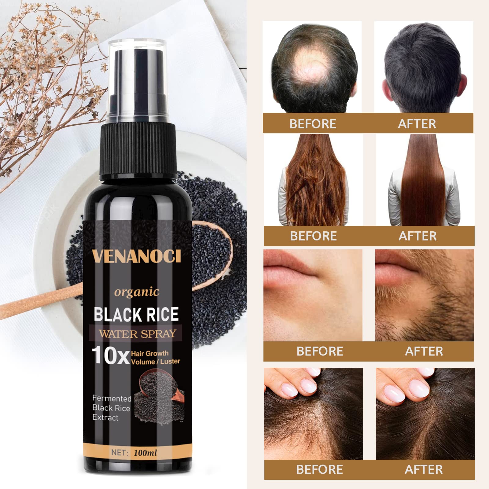 Foto 4 pulgar | Sérum Para El Crecimiento Del Cabello Venanoci Rice Water Spray Para Mujeres Y Hombres - Venta Internacional.