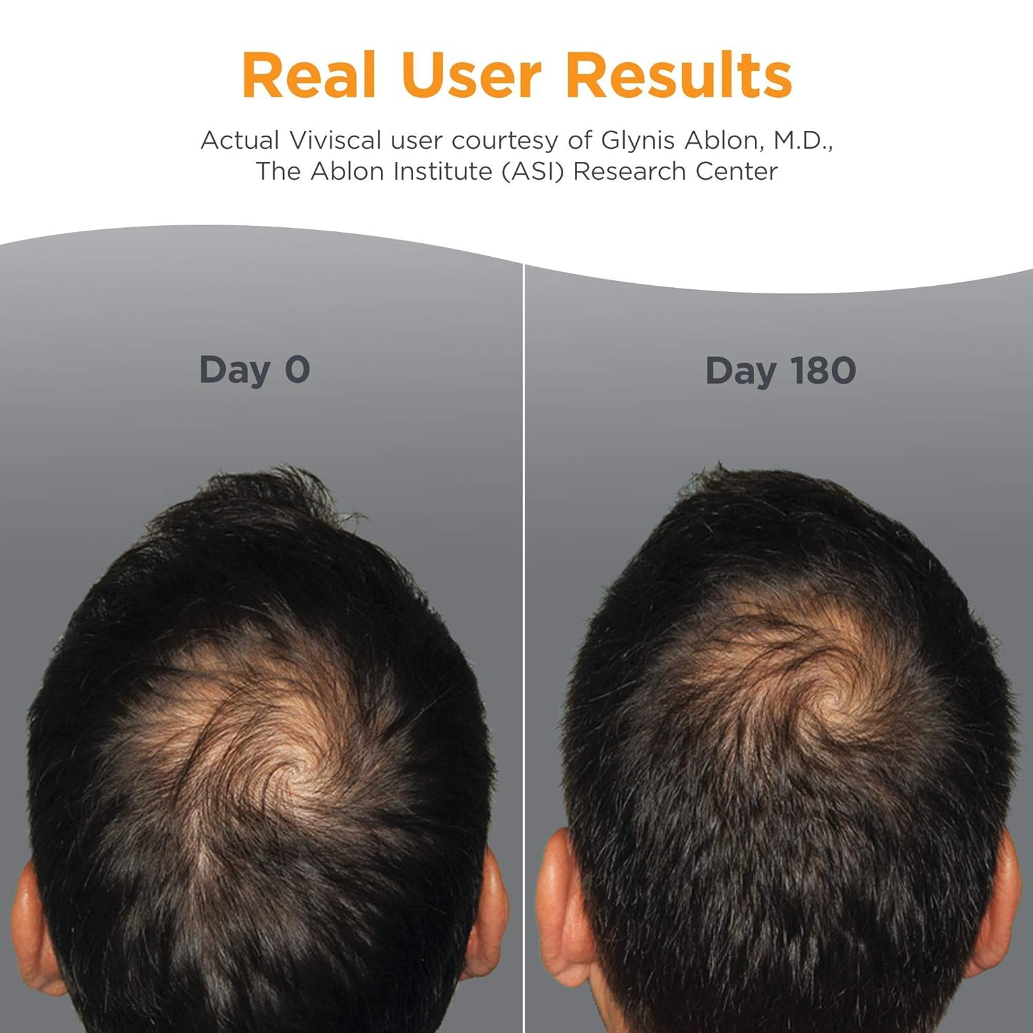 Foto 4 pulgar | Suplementos Para El Crecimiento Del Cabello Viviscal Men 180 Comprimidos Durante 3 Meses - Venta Internacional